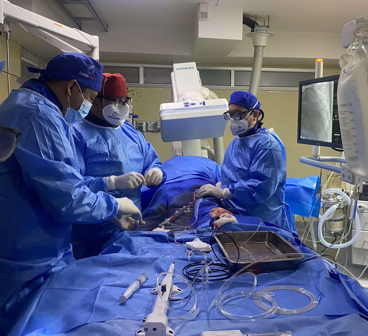 FaustoHerediaDr's tweet image. 🇪🇨Noche de #Rotablator en @HC_SanFrancisco por Acceso Radial Izquierdo #CardioHeredia