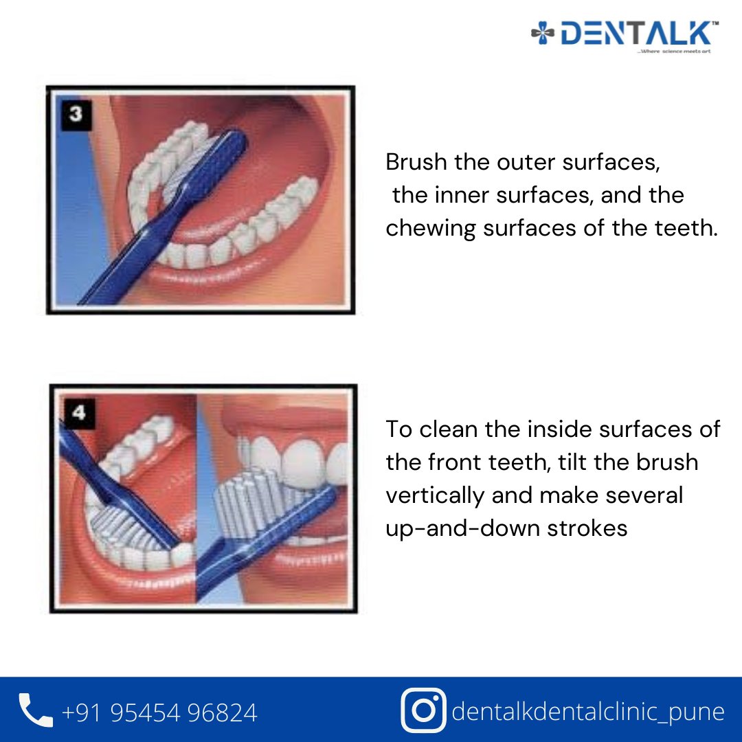 ClinicDentalk's tweet photo. #toothbrush #toothbrushing https://t.co/iMVtDct0Vu
