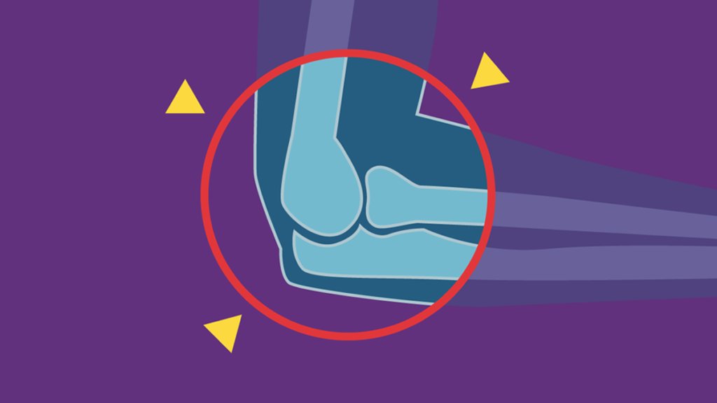 We need your help! Only just over a week left to participate in <a href="/DFTBubbles/">Team DFTB</a>' elbow x-ray research study. 

Closing date: 7th September 2021

To participate go to research.dftbdigital.com