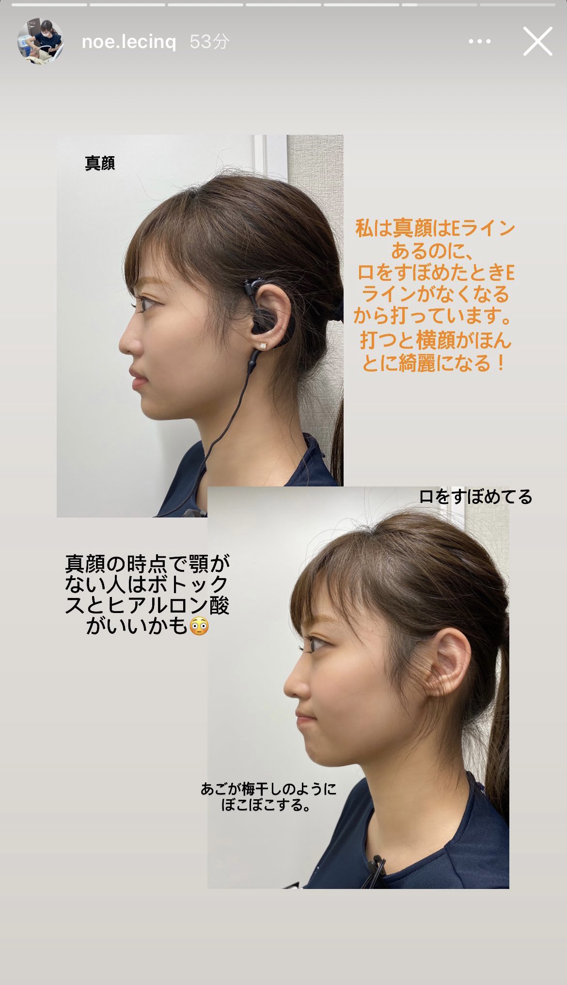 汚 Ruixichan Twitter