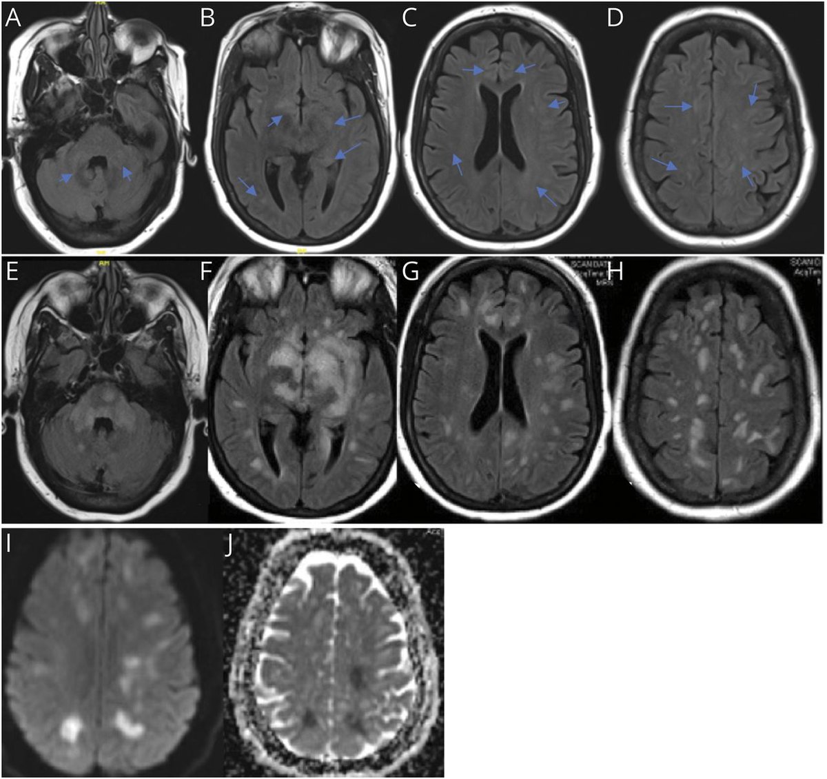 Neurology Journal tweet media