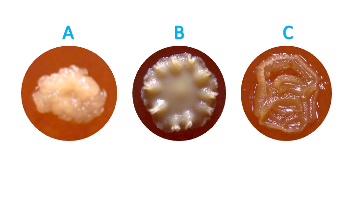 built_tx's tweet photo. Who's your favorite oral microbial colony from this week's isolation? 👅 🧫🔬 #Microbiome #OralHealth @indbio @harvardlifelab https://t.co/SNZPAZFJH4