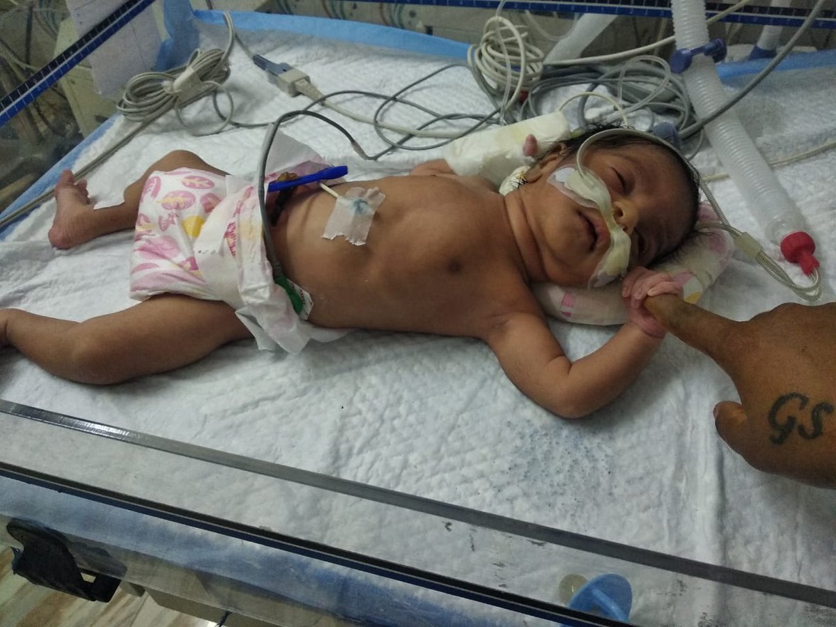 SureshChidural3's tweet photo. @SonuSood @SavetheChildren @childrensociety @Hanumavihari @ketto This child is 4days old suffering from Pneumonia. Please help them Contact: Yakaswamy(father) Mobile no : 9618337063 https://t.co/wNoKqDUim1
