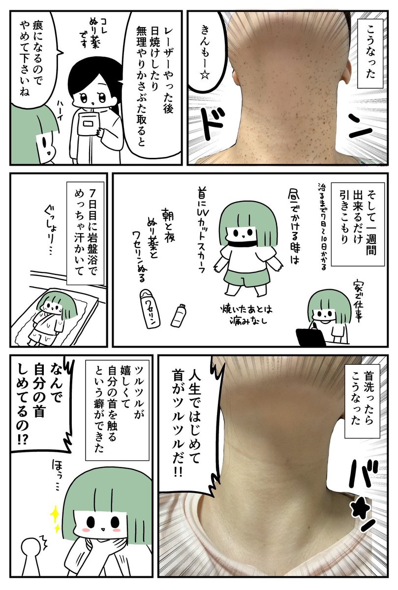 首のイボ全部焼く② 

※ブツブツ画像注意！！！！

  