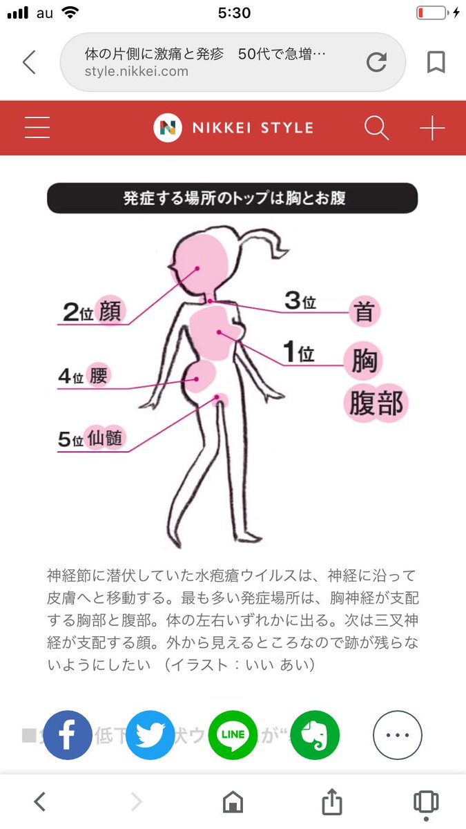 疱疹 場所 帯状