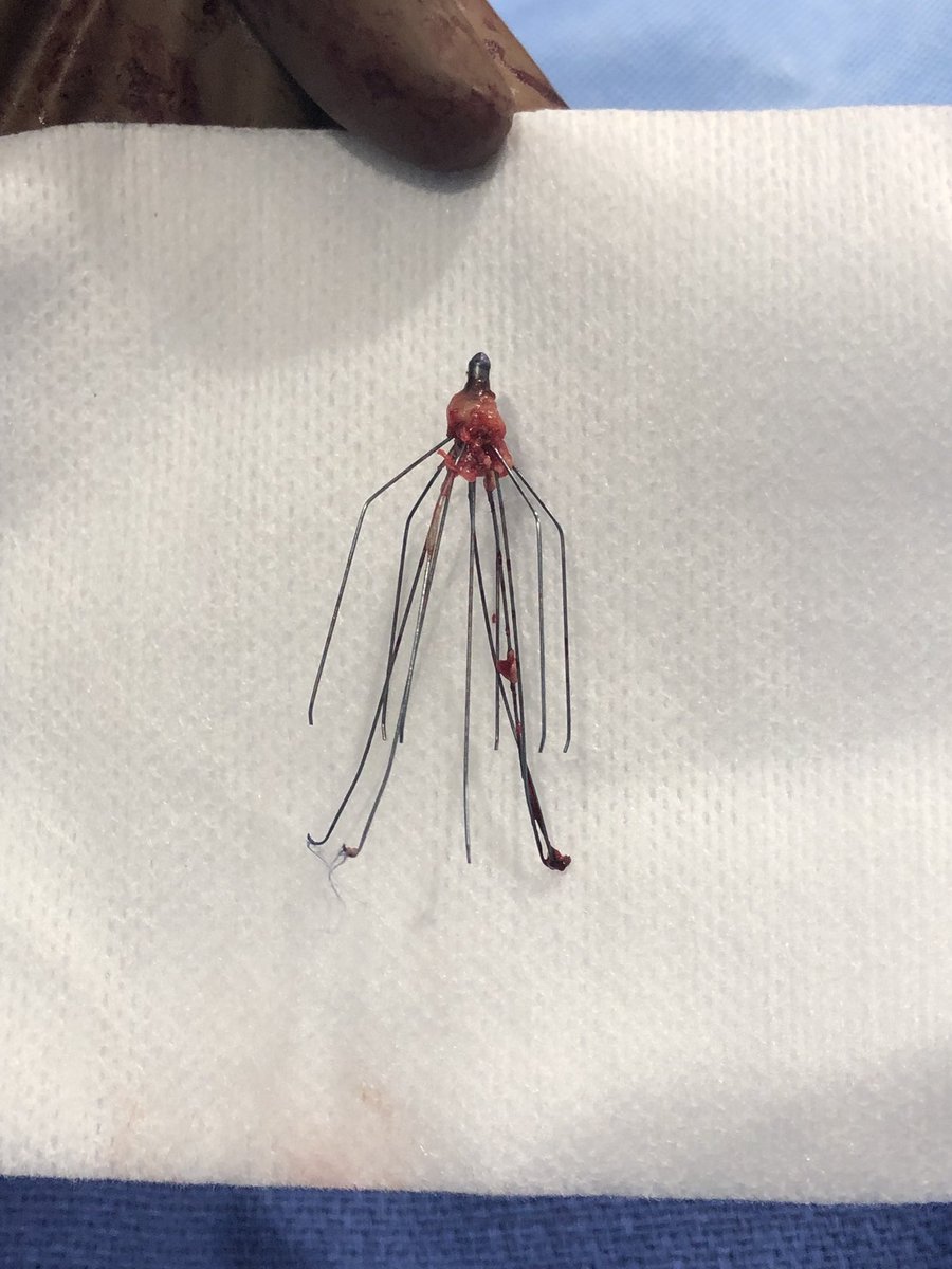 AHFairchild's tweet photo. #filterout complex filter retrieval with @Crazymed0910 and Dr. Matt Scheidt. Fun times. @SeanTutton @MCW_VIR https://t.co/7hJlxd3n4U