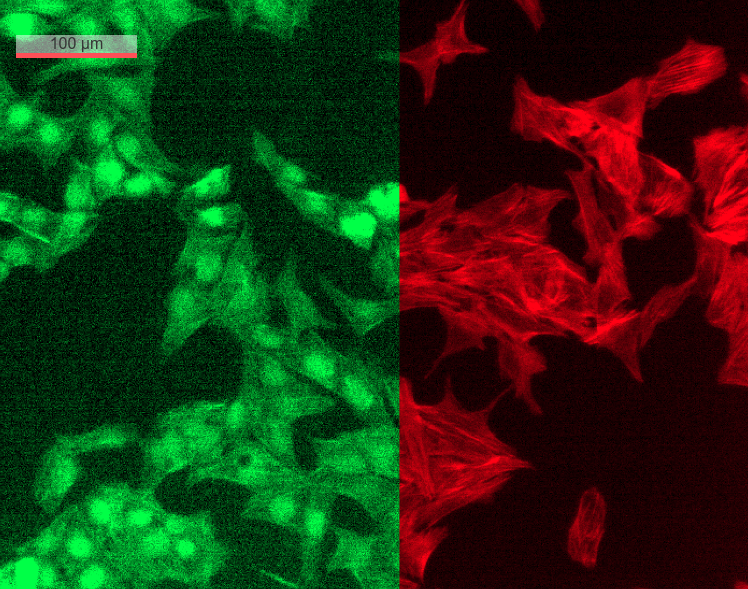 antonysigma's tweet photo. Our work on the 96-in-1 parallel #quantitativephase and #fluorescence #microscope at @Caltech  is reported in #scientificreports. Thank you @Amgen and @croucherFDN  for making this happen!
#highthroughput #highresolution #FPM
https://t.co/hO9acCWCHJ https://t.co/83gjt9aI1F
