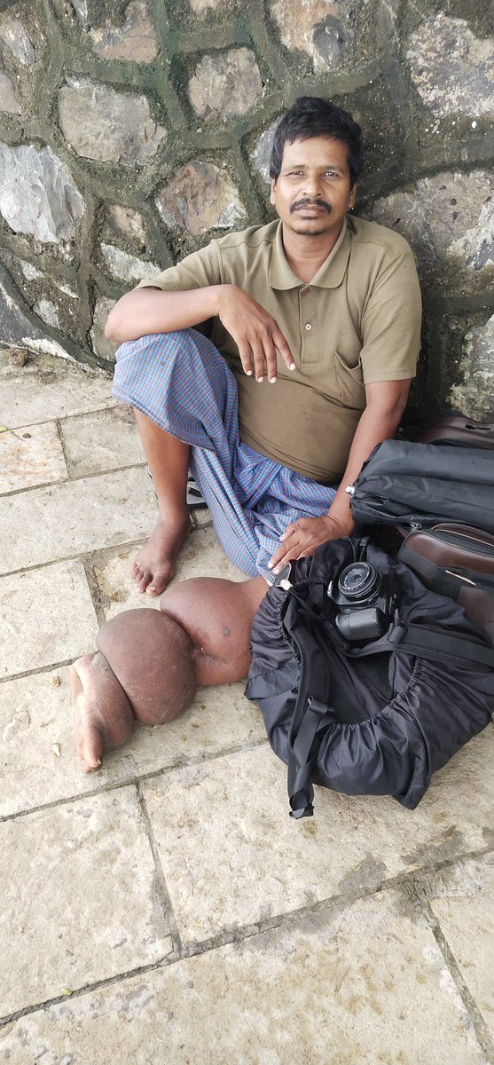 firozeshakir's tweet photo. Majid my friend has #elephantisis but does not complain.
#MuslimBeggars
#Bandra
#Bandstand
I have a lot of friends among beggars I help them too. https://t.co/E9KhMN8Xtg