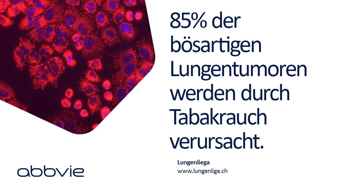 Der 1. August ist Welt #Lungenkrebs Tag #WorldLungCancerDay. #Rauchen erhöht das Lungenkrebsrisiko um das 20- bis 30-Fache.  bit.ly/2YuyelH @Lungenliga