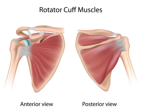 DrJeffPadalecki's tweet photo. #RotatorCuffPain commonly radiating from the outer arm to several inches below the top of the #shoulder is the classic symptom of this type of #shouldertendonitis
#RotatorCuffTendonitis symptoms also include...https://t.co/Zx8tvQwXLh https://t.co/ZFpzb2ViDa