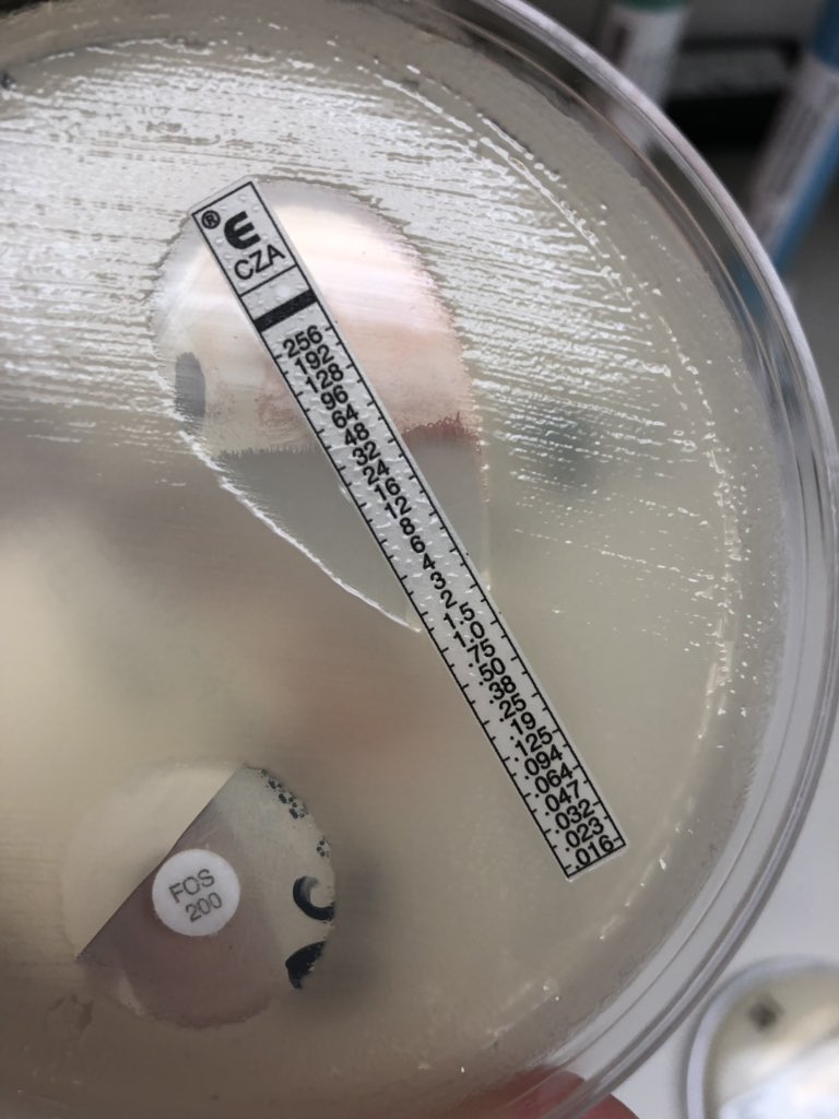 nmoore07's tweet photo. #MicroRounds Day 23: Female w/ recurrent and symptomatic UTI. Growing >10^5 CFU/mL of Klebsiella pneumoniae. Based on added AST performed, can you determine what resistance mechanism to suspect? #IDpath #medtwitter @RushCCH_ID https://t.co/CevCne4k2G