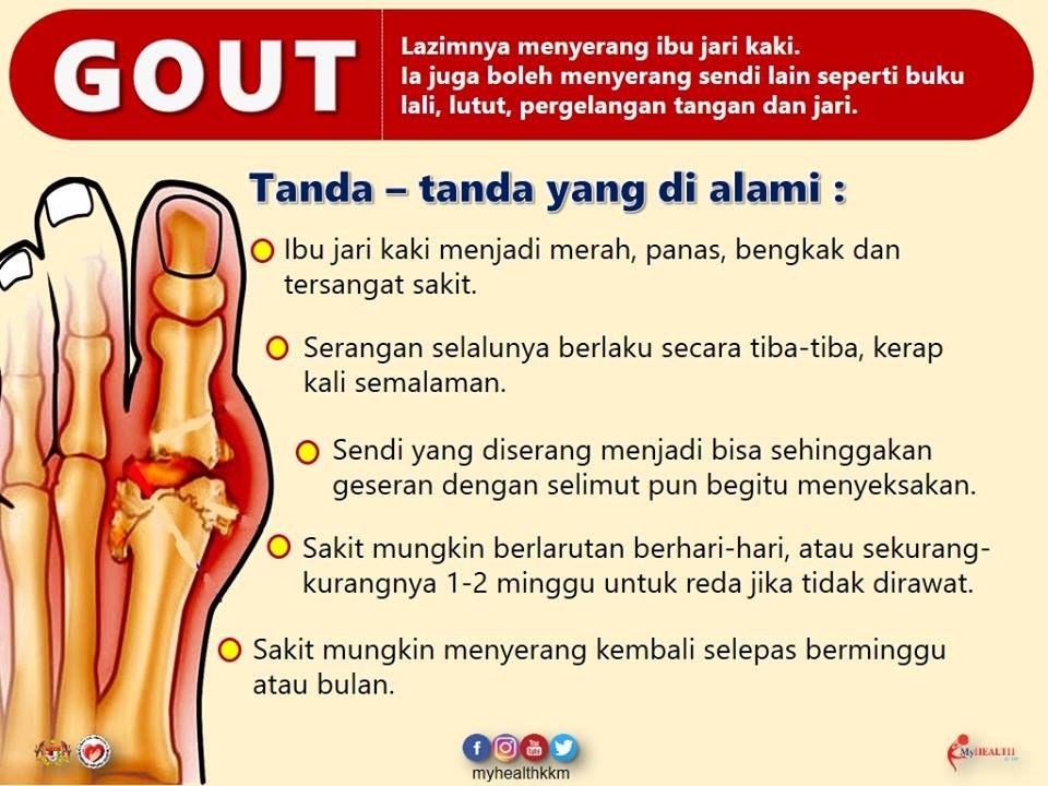 Geng Farmasi Otai On Twitter Salicylates Including Aspirin Should Be Avoided During An Acute Gout Attack As Salicylates May Increase The Levels Of Uric Acid Concentrations In The Body Due To Reduced