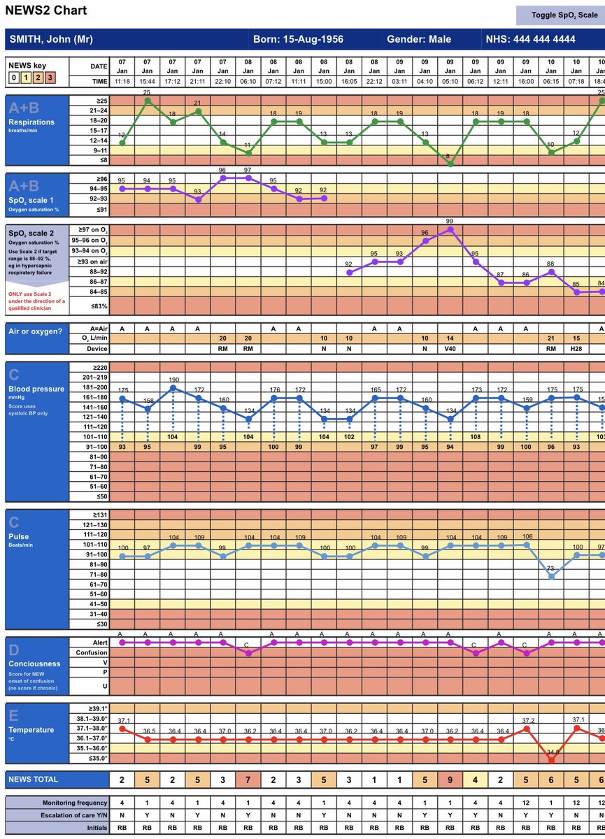 News Score Chart