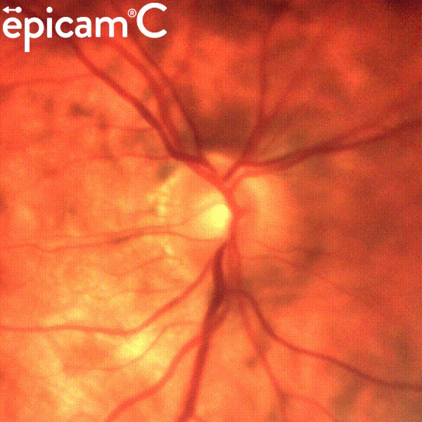 epipole_ltd's tweet photo. If all of these systemic conditions are visible in the eye:
https://t.co/cUgcJi6xej
why do so few GPs ever use an ophthalmoscope?
@NHS_HS @NHSuk @NHSEngland @NHS_Education https://t.co/S3bjKOsubJ