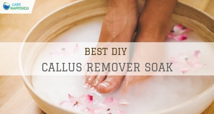 Best DIY Callus Remover Soak
carehappiness.com/best-diy-callu…