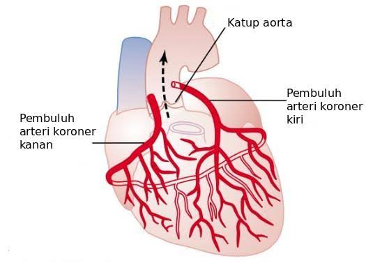 Nah begitu juga dgn jantung. Jantung juga butuh makanPembuluh darah yg bertugas memberi oksigen dan nutrisi bagi jantung adalah Pembuluh KoronerDiameter pembuluh ini sangat sangat sangat kecil sehingga rentan tersumbat, terutama jika punya lemak/kolesterol tinggi
