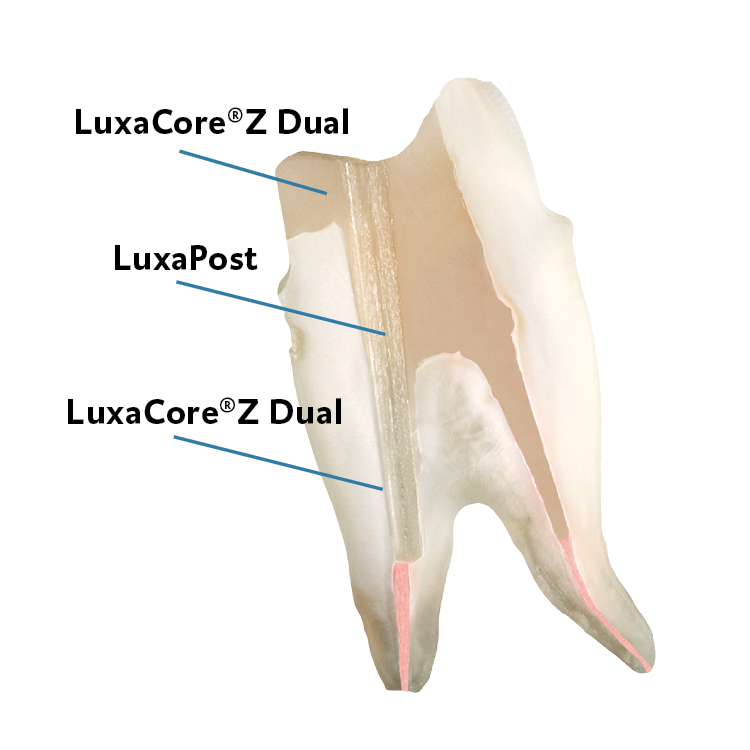 DMGAmerica's tweet image. We've got your complete system for #postandcore. bit.ly/2LgLJyo