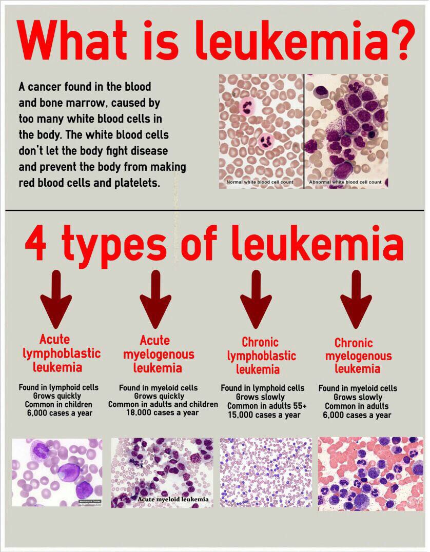 lab_phot's tweet image. صورة حلووووووووه مختصرة جدا وفي نفس الوقت مفيده 
Different types of leukemia