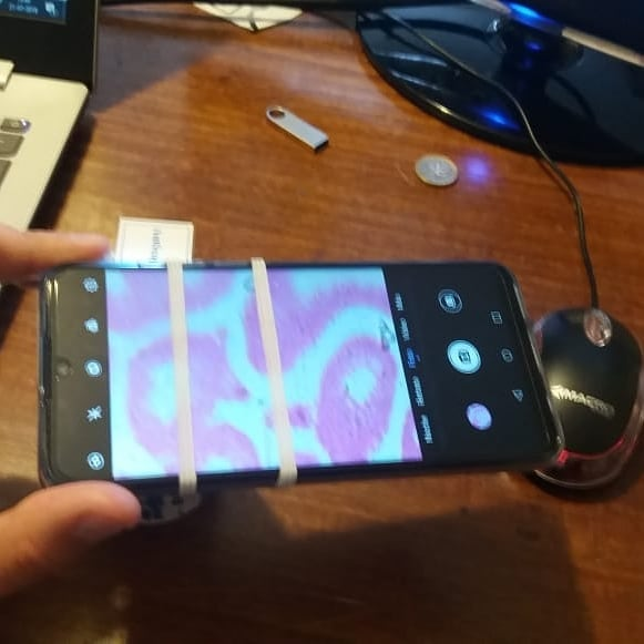 MarianoEliseoR's tweet photo. Fotos capturadas por #microhoek y un #huaweip30. Realmente increíble 😲 #microscopicimage #science @HuaweiMobileCL https://t.co/Qs9VeXAlEX