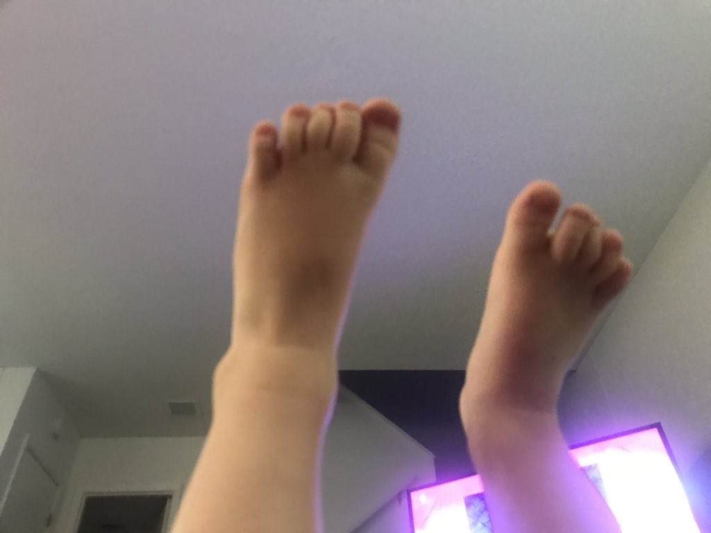 funanna1984's tweet photo. @chrissyteigen Me tooooooo! And now my baby likes to take pics of his own little piggies https://t.co/kW7xk1UfIw