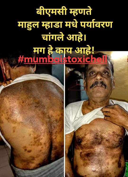gajanansibm's tweet photo. #mumbaitoxichell @BJP4India @Dev_Fadnavis @CMOMaharashtra @narendramodi @AUThackeray @INCIndia @PMOIndia @RahulGandhi @AmitShah @TawdeVinod @BJP4Maharashtra @KiritSomaiya @poonam_mahajan @medhanarmada @Dhananjay4AAP @ShainaNC @GajananKirtikar @RavindraWaikar @uddhavthackeray https://t.co/5pQiM6frzc