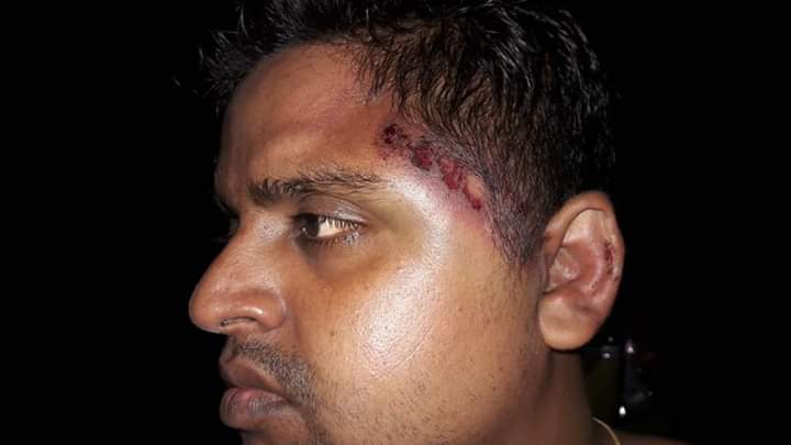 dhbarbhuiya1's tweet image. I strongly condemn the Inhuman attack on @DY365 Reporter, Hailakandi Mr. #Rajesh_Das.Strong demand to the @HailakandiPolic  &amp;amp;  @dc_hailakandi Administration to Immediately arresting the miscreants and give exemplary punishment.. @CMOfficeAssam @assampolice @news18assam