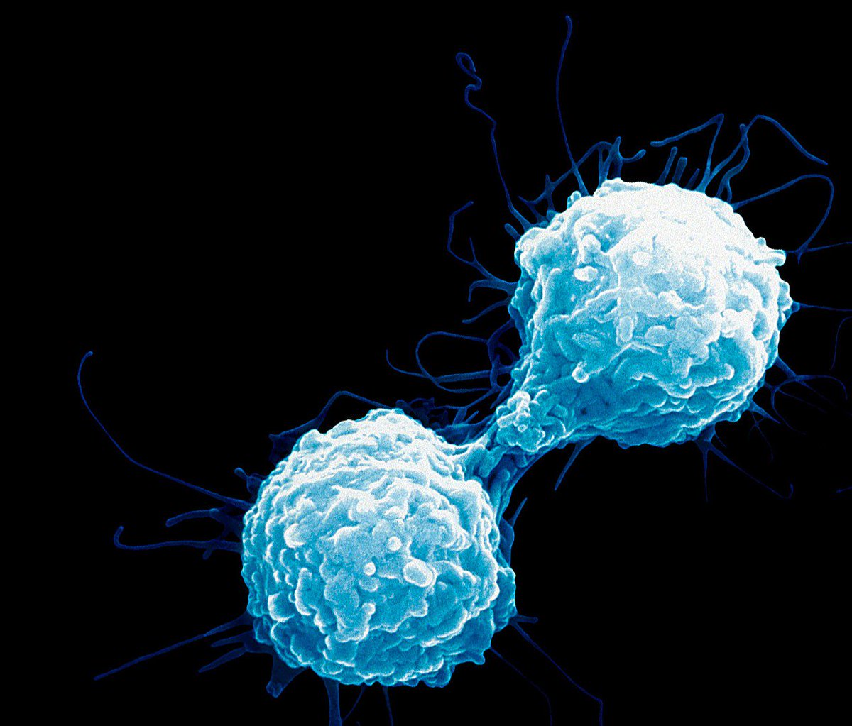 oncologists's tweet photo. know more details at https://t.co/7bp3BHOSAP
Novel immunotherapy shows a breakthrough in clinical trial to treat lung cancer. 
 #TummorImmunology #ClinicalTrails #Oncology  #RadiationTherapy #Cancer
Join us at #OncologistsCongress2019 on #December09_10,2019 at #Baltimore,USA https://t.co/OyyCIptHmj