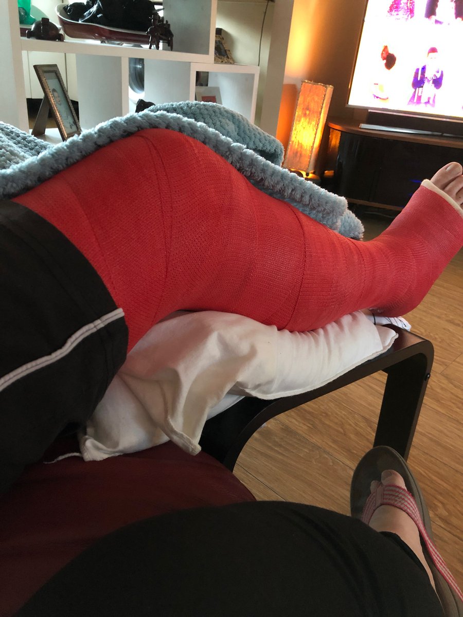 PoshSpuds's tweet photo. We're so sorry we've missed you so far this summer.  Its been 4 (very) long months, but Alan is finally out of plaster.  We hope to see you again very soon! https://t.co/v2GwvHHABB