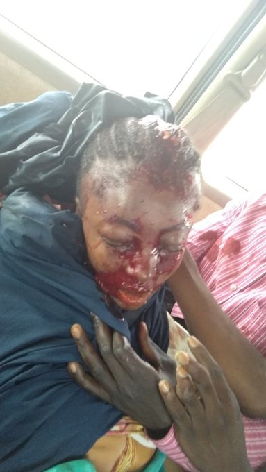 Many feared dead as Shiites and police engage in fierce gun battle in Abuja (photos)