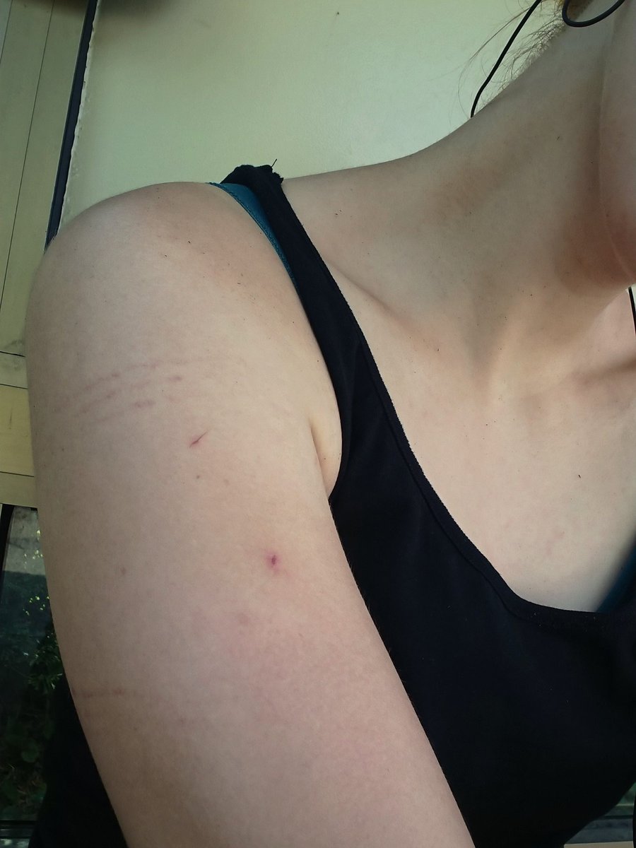 GRefurinn's tweet photo. When your skin is really sensible and everybody asks you now, why you have rope marks on your arms
#strangehobbies #shibari https://t.co/pGzyFPy3fc