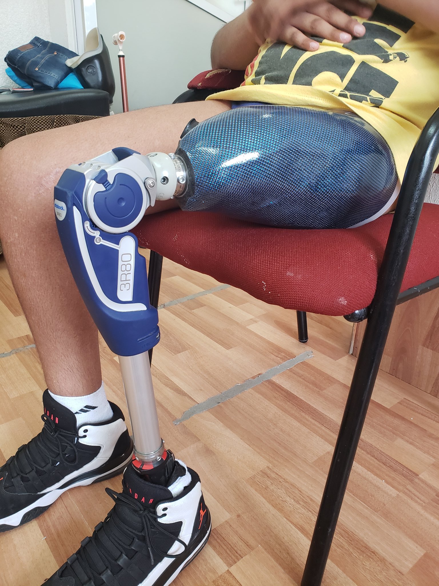 Alberto Villicaña Ortega on Twitter: "#protesis #ottobock #rehabiltar #3R80  #triton #ciencia #profesion https://t.co/V49Y72dIK1" / Twitter