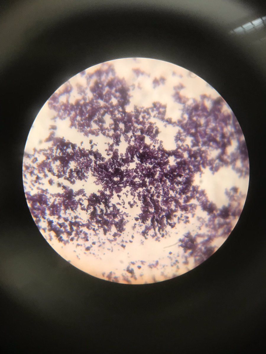 Kirsten_Littrel's tweet photo. Gram staining:
Purple= gram POSITIVE
Rods= bacilli
LINKS=DIPLObacillus
Circles=cocci
clusters= STAPHYLOcocci
#LABISCOOLER #HANDSON #MICROISCOOL @MMCBiology @MMCMicrobio https://t.co/e6yygMuZQx