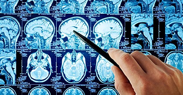 "If your health care provider orders an MRI, ask these three questions to get the information you need to make an informed decision."
bit.ly/2wQx1Wt