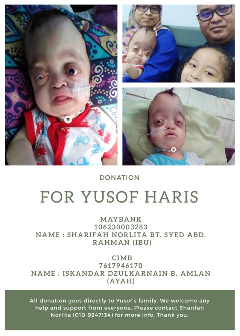 jiaohjia's tweet photo. Dear all, I’d like to urge everyone to help Yusof Haris. He’s suffering from Pieffer Syndrome since he was born and he’s 1 yo now. He needs RM26,700 to undergo his first surgery next month so a lil help from everyone is very much appreciated. See details in the poster. https://t.co/tUxahf0cP5