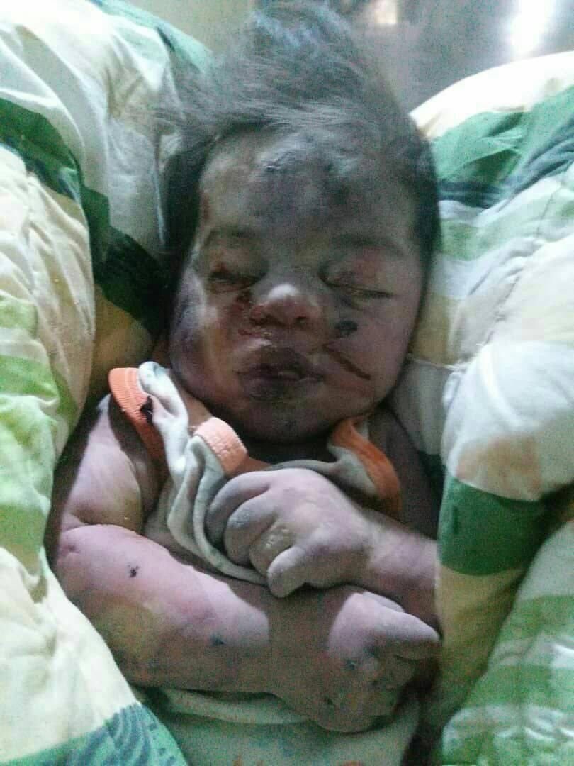 SyriaCharity's tweet image. ⚠️ #ATTENTION #choquant !

Quand on fait une tuerie, on doit au moins en connaître le visage. 
Cette petite a perdue la vie après les violents bombardements sur Mara Al-Nu&apos;man. 

Nous avons hésité à la poster mais il est important que nous voyions la réalité en face. 👇🏼