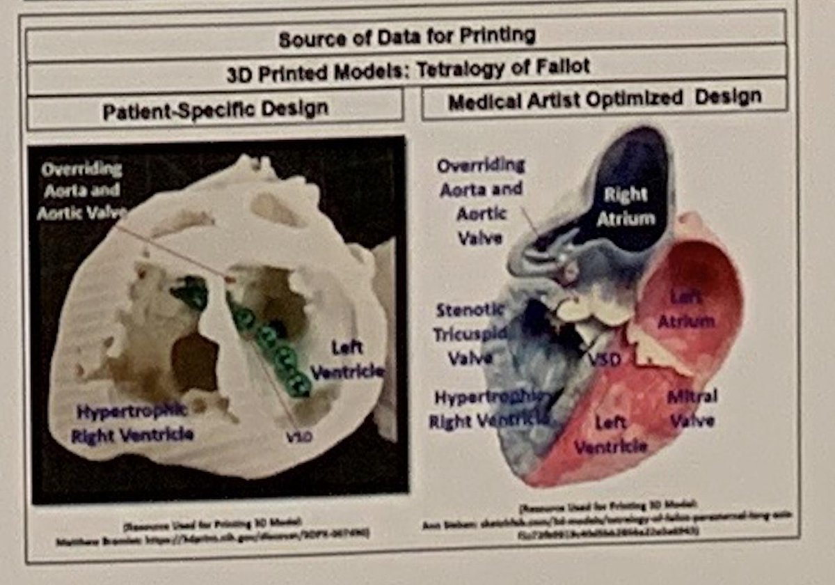 YonahZiembaMD's tweet photo. Educators in many institutions  print out an outline when they need to teach medical students about Tetralogy of Fallot. But at East Carolina University they print out a 3-D model of the heart. Impressive. @ECUBrodySOM #APC19Boston https://t.co/wf5rlfCIXV