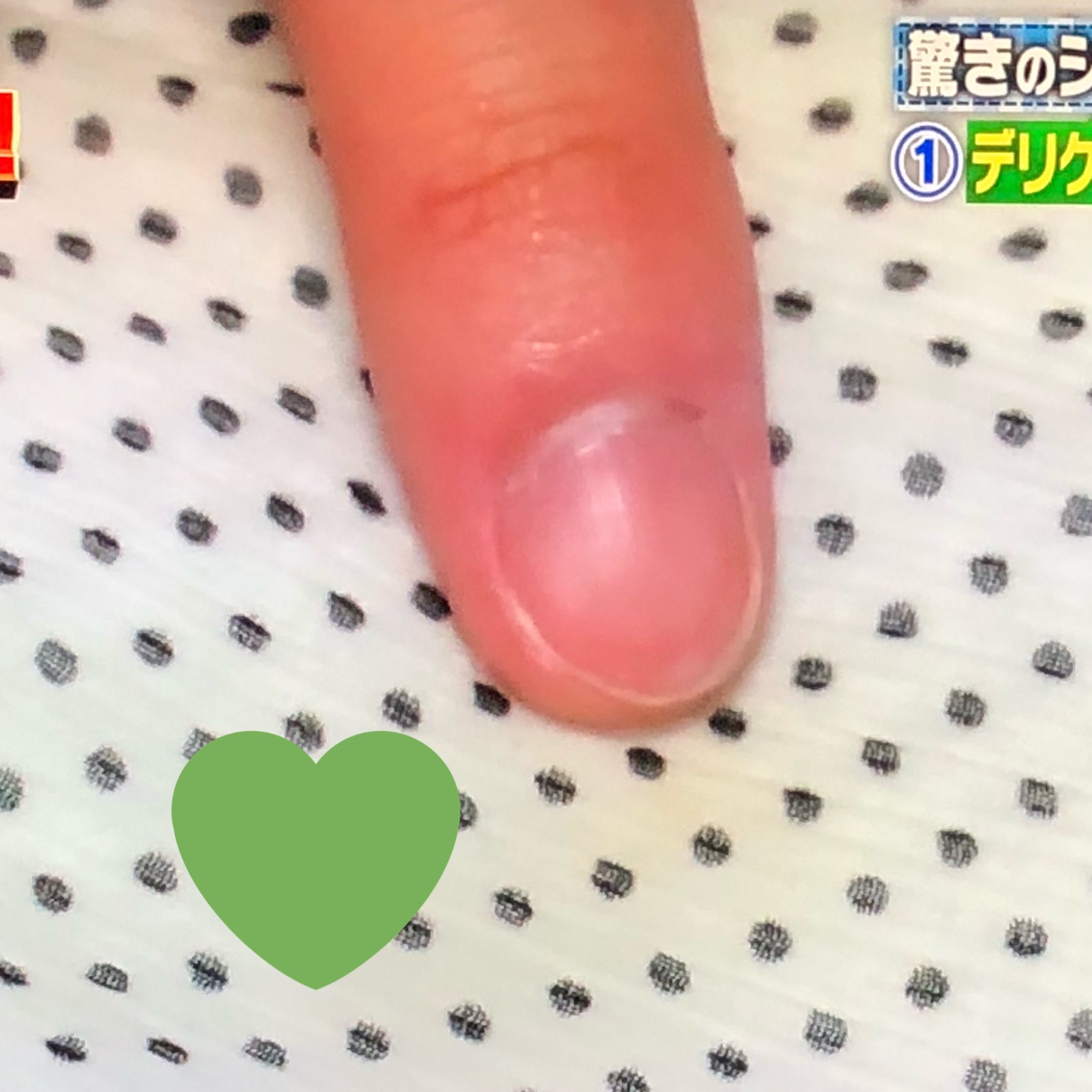 うる 綺麗な丸爪で白いところスレスレまで切る猪狩蒼弥 四角い爪で割と伸びている髙橋優斗 長方形寄りで爪が伸びすぎてないけど 白いところ多めの作間龍斗 T Co R6riimffg7 Twitter