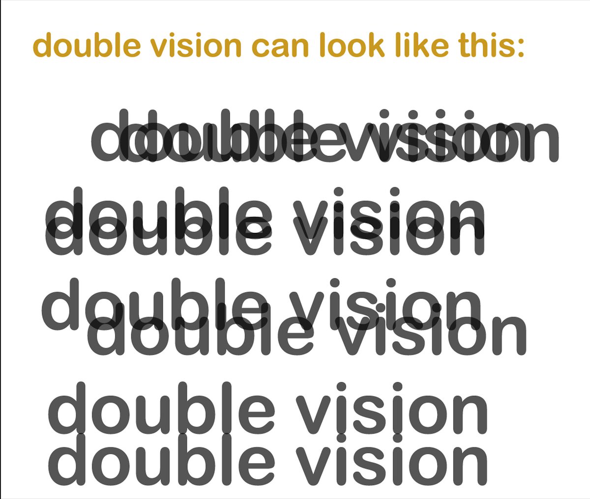 LoxleyOpticians's tweet image. 3: Seeing double may indicate problems with your cornea or eye muscles. It can also be a symptom of cataracts.