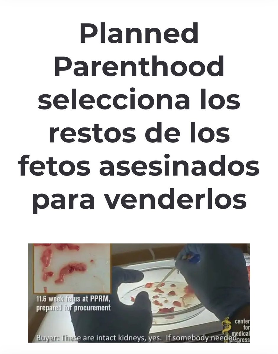 Astrea1014's tweet photo. @YoSoyDiamante12 @CurichumbiPedro @BloqueCREO21 @HectorYepezM @XimenaPena1 @henrycucalon @GuillermoCeli @etorrescobo @viviana_bonilla @ppsesa @RosaOrellanaOF @drwilliamgarzon Sabemos que el articulo 201 pide CONFIDENCIALIDAD en los abortos  , y se lo debe eliminar RADICALMENTE porque encubre a violadores y el tráfico fetal .
Ya sabemos perfectamente que #plannedparenthood  #ipff  #GeorgeSoros son los que buscan mercado latino, en USA ya lo perdieron https://t.co/TVYrxht0AX