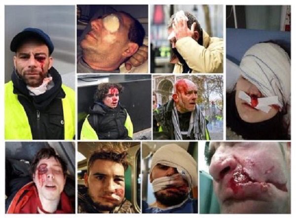 tktmartin's tweet photo. @SibethNdiaye @gouvernementFR #2ansdaction , ça pour de lâaction, il y a eu de lâaction.
Le peuple a bien été marqué, et ce, jusque dans sa chair.
Cependant, je ne suis pas certain quâils vous en soient reconnaissant đđ
On verra aux #municipales2020 đ https://t.co/ZQYGUGexgy