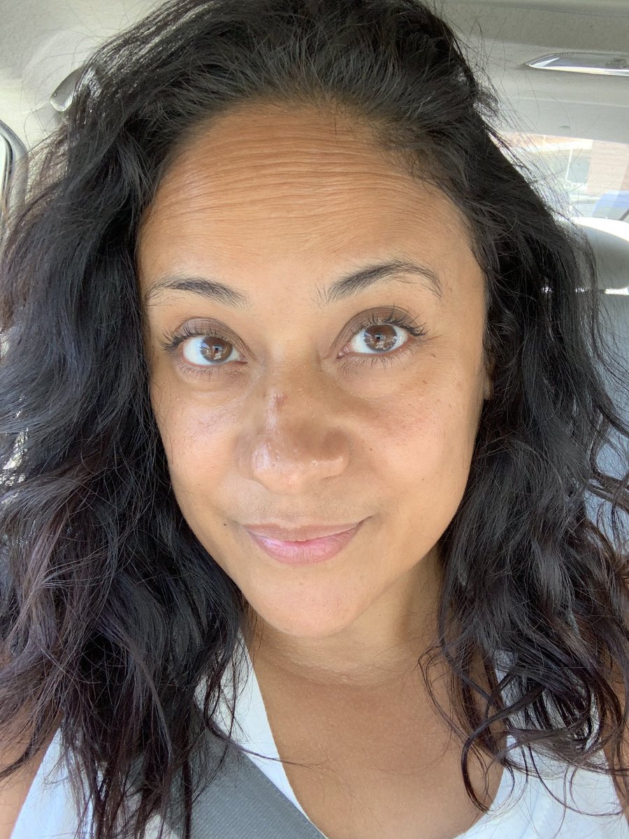 LianaRodz31's tweet photo. Found a new addiction... #LaserAndLightFacial #SkinLaundry #HydroBoost #SantaMonica #CaliforniaLiving #NoFilter #ThisIs40 https://t.co/0dTTmQMt0r