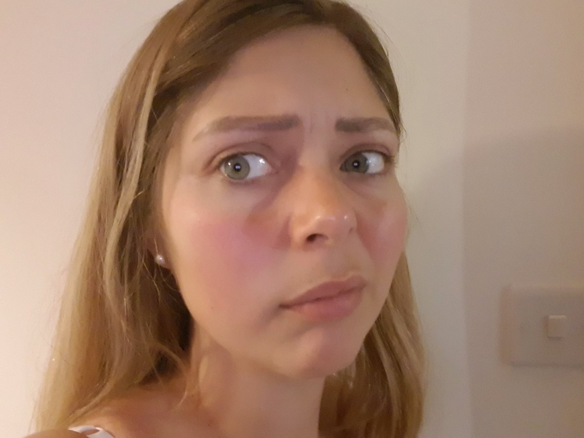 WinterKaty's tweet photo. @EcoByNaty not sure what's going on here with your Sensative Wipes but my face has gone very red!! What a shame as lovely to find some #Biodegradable wipes for #SensitiveSkin thought you ought to know they may not be as sensitive as the packaging claims #BackToTheDrawingBoard https://t.co/uuC5cSPDCP