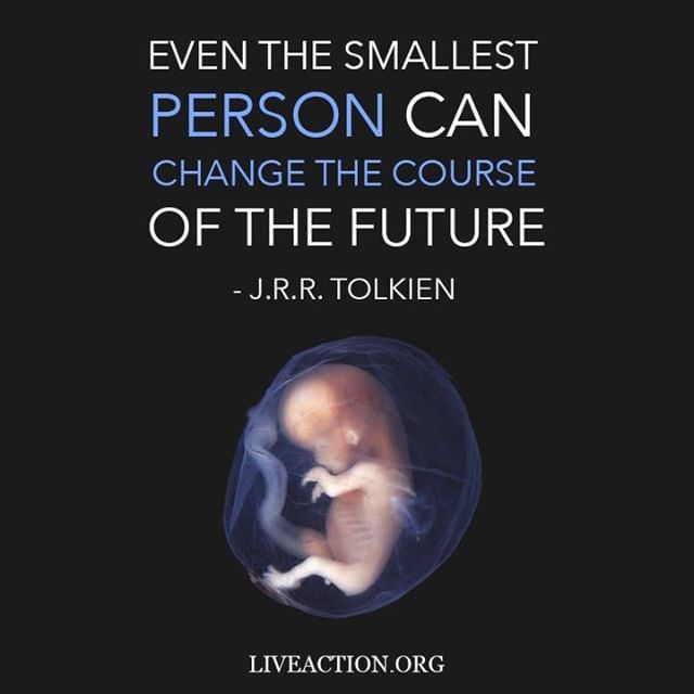 LiveActionNews's tweet image. Every child deserves the chance to live up to their full potential. ift.tt/2ya3p6W