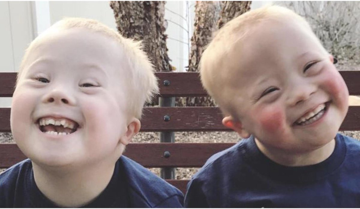 3 Year old down syndrome twins ...#socialmedia #inspiration 
today.com/parents/inspir…😊