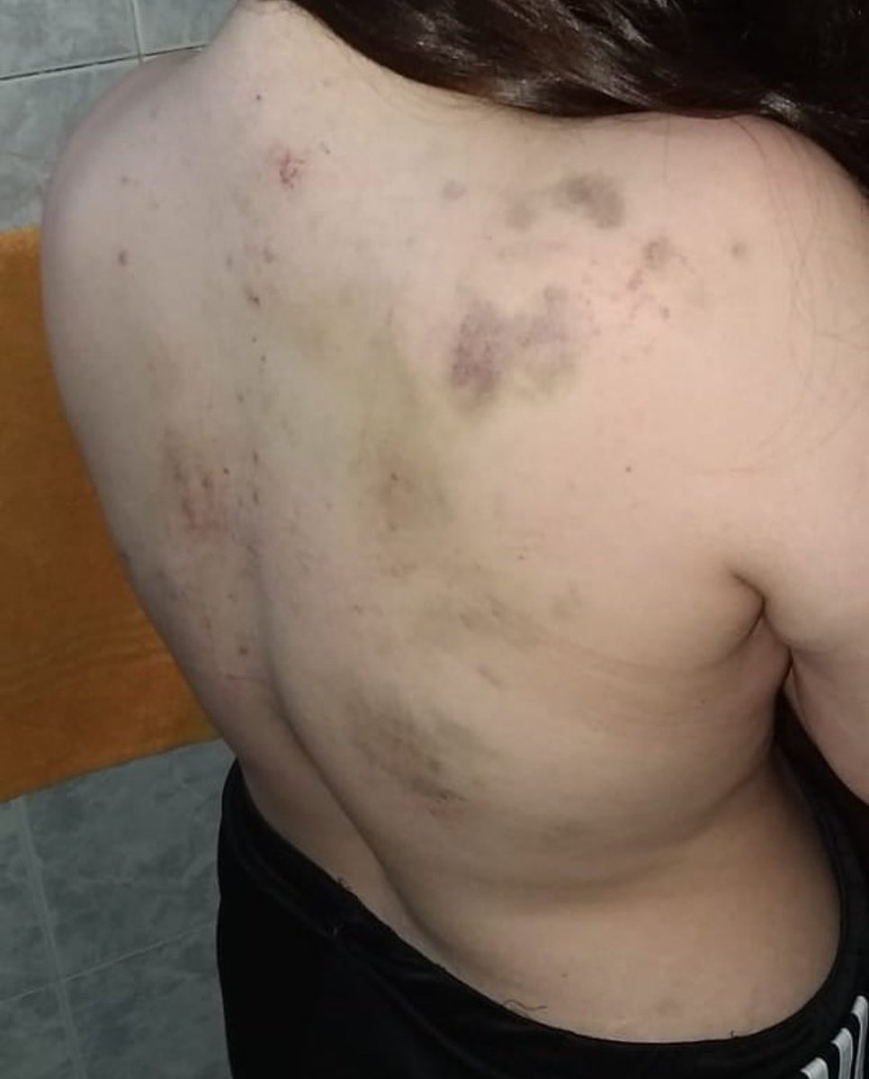 anonimma13's tweet image. Acabó de ver esta publicación de esta chica y realmente se agradece difusión. Ella es Yanina Andrade. POR FAVOR DIFUNDIR
Abajo público lo que ella contó en sus redes sociales. 
Es un ASCO que tu familia te haga esto