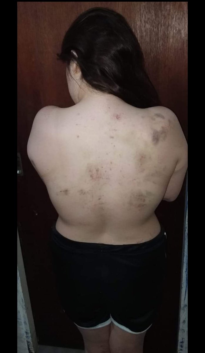 anonimma13's tweet image. Acabó de ver esta publicación de esta chica y realmente se agradece difusión. Ella es Yanina Andrade. POR FAVOR DIFUNDIR
Abajo público lo que ella contó en sus redes sociales. 
Es un ASCO que tu familia te haga esto