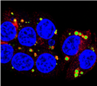 Lipid droplet dynamics grant new insight into solid tumor metabolic requirements and responses to microenvironmental signals. #OnlineFirst
bit.ly/32QOjRX