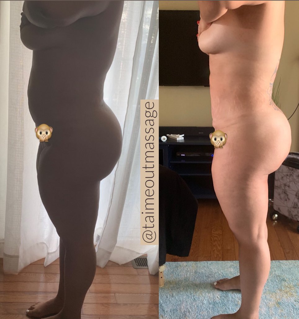 tosiuniversity's tweet photo. #body #bodycontour #slimwaist #weightloss #transformation #fitness #healthy #massage #dmv #dmvnetwork #bodysculpt #atlanta #atlnetwork #bodysculpt #ClintonBodyCount #RickyRenuncio #ThursdayThoughts #answer #Madden20 #ThursdayMotivation #NayaPakistan_Day #hottestdayoftheyear https://t.co/xn3umaq8Xk
