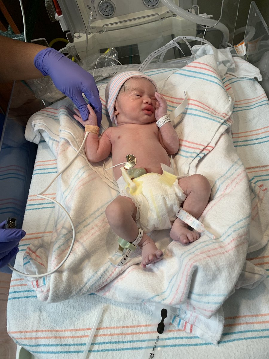 Ronnie17_'s tweet photo. Liahm Alvaro Mason ♥️
5lbs 7oz
18inches
Born 7/25/19 2:04pm https://t.co/tKPa0OkFPp