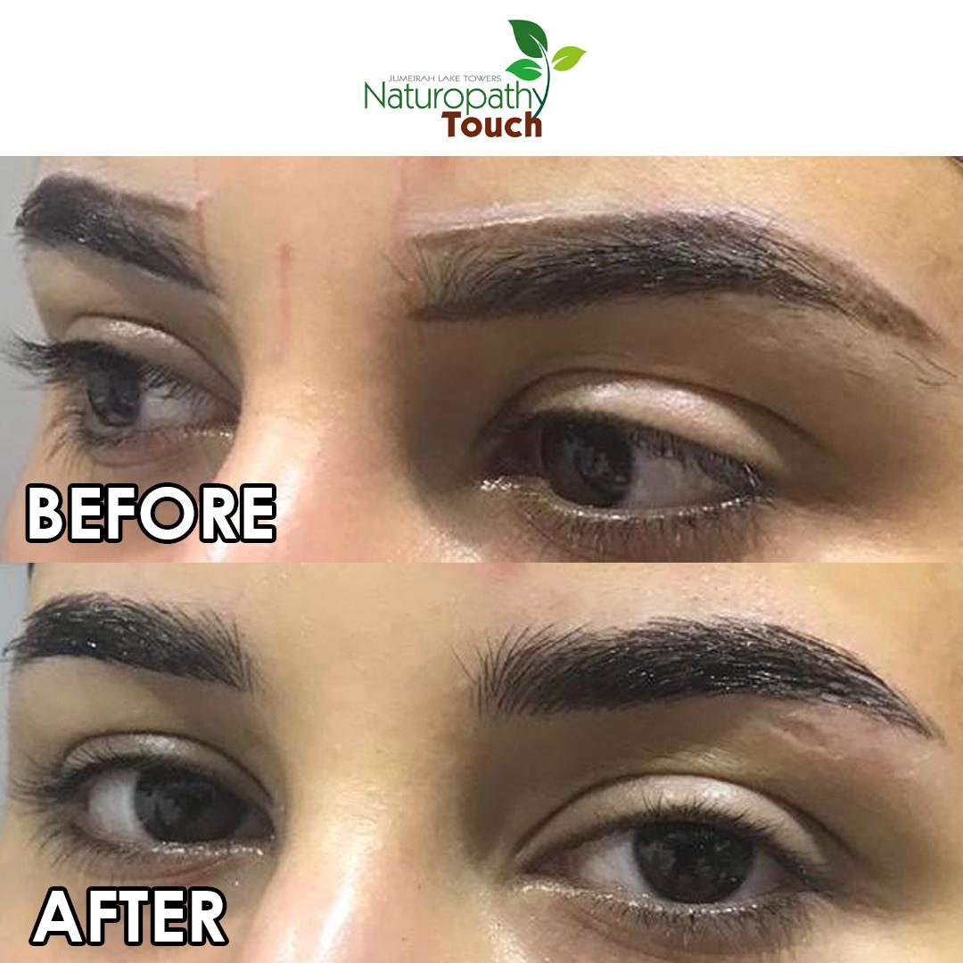 NaturopathyJLT's tweet photo. Who doesn’t dream of natural done brows?
PMU Academy knows the Microblading field the most…
Thanks honey for trusting us!
⁣#Microblading #PMU #ScalpMicropigmentation #SemiPermanentMakeup #LipsCosmeticTattoo #EyelinersCosmeticTattoo ⁣
⁣#tattooremoval #permanentmakeupremoval https://t.co/z14H6jr1FR